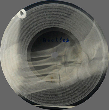 One-sided flexible record made of X-ray pattern – односторонняя гибкая пластинка, сделанная из рентгеновского снимка