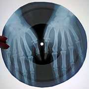 One-sided flexible record made of X-ray pattern – Односторонняя гибкая пластинка, сделанная из рентгеновского снимка