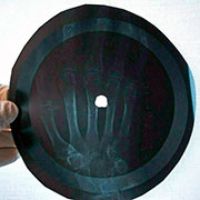 One-sided flexible record made of X-ray pattern – Односторонняя гибкая пластинка, сделанная из рентгеновского снимка